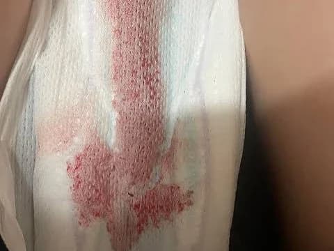 Absorvente usado